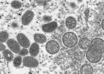 Toronto Public Health confirms first case of monkeypox