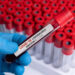 New Omicron subvariant detected in Canada